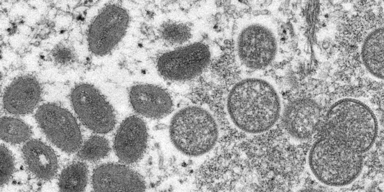 Biden officials to expand monkeypox testing amid fears of undercounting