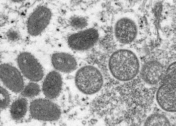CDC: 20 monkeypox cases detected in 11 states, viral strain identified