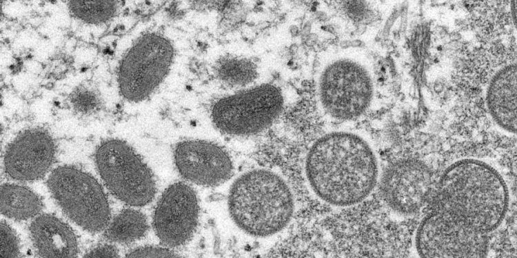 Monkeypox cases in New York City double in past week