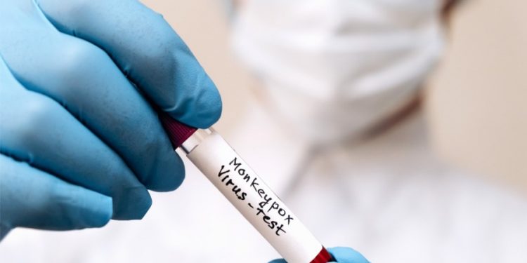 Monkeypox has reached all 50 states