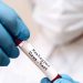 New York reports first juvenile monkeypox case