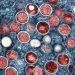 WHO renames monkeypox as ‘mpox’
