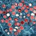Public health, LGBTQ advocacy groups say nation remains unprepared for next outbreak