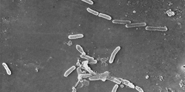 Outbreak linked to eyedrops leaves 68 infected, 8 blind and 3 dead, CDC says
