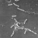 Outbreak linked to eyedrops leaves 68 infected, 8 blind and 3 dead, CDC says