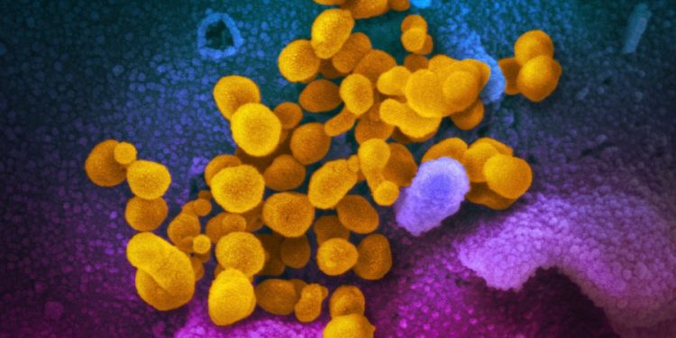 Long COVID symptoms can linger for two years, study shows
