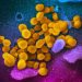 Long COVID symptoms can linger for two years, study shows