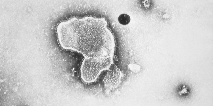 FDA approves first RSV vaccine to prevent infections in infants