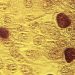 Chlamydia vaccine shows promising results in early-stage trial