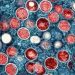 Elevated mpox cases spur efforts to avoid summer spread