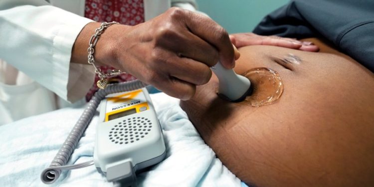 Almost 7M Black women of reproductive age have little, no abortion access: Research