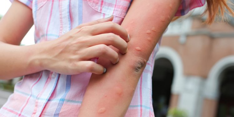 What to know about the mosquito virus spreading through New England