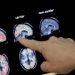 FDA clears first blood test to reliably predict Alzheimer’s disease